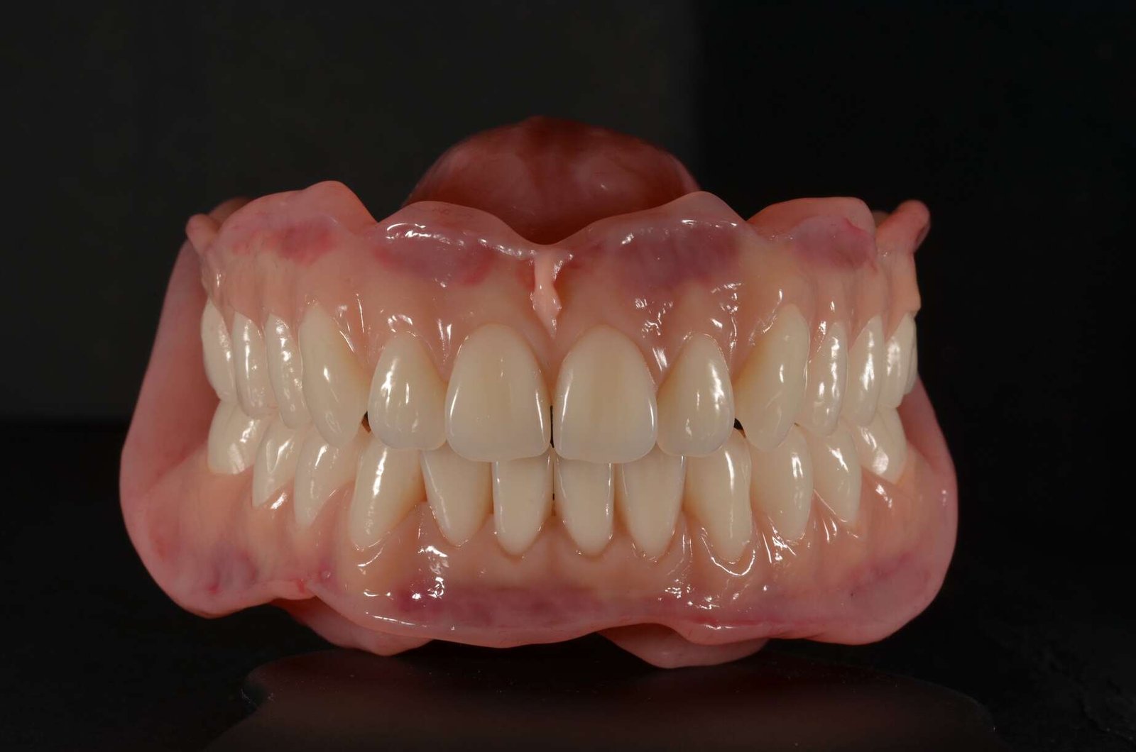 Dentures in Chicago cost between 00 and ,514, depending on whether you need partial or full dentures. Partial dentures typically range from 00 to ,000, while complete dentures average ,968 but can exceed ,000 for premium options. Most dental insurance plans cover 50% of costs after deductibles. Dentists in Chicago downtown charge more than suburban locations, though many offer payment plans and CareCredit financing to make treatment affordable.