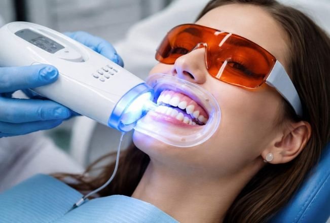 Teeth Whitening in chicago il