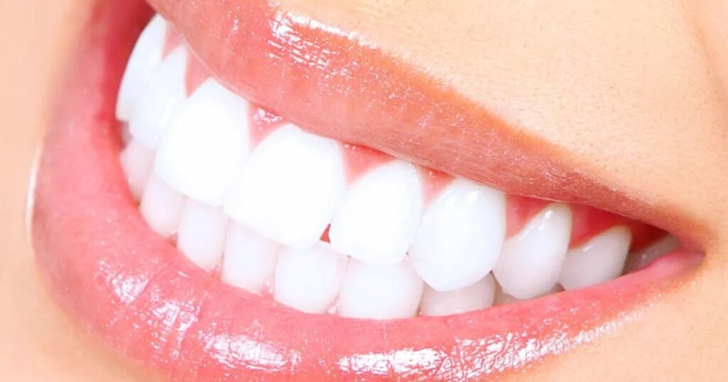 how to whiten teeth quickly